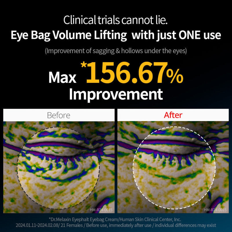 Dr Melaxin - Eyephalt Eyecream Top Selling